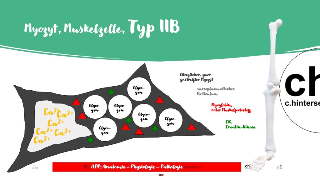 Schematische Darstellung Typ IIB Muskulatur