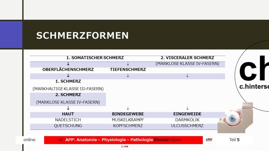 Scheamtische Darstellung der Schmerzformen