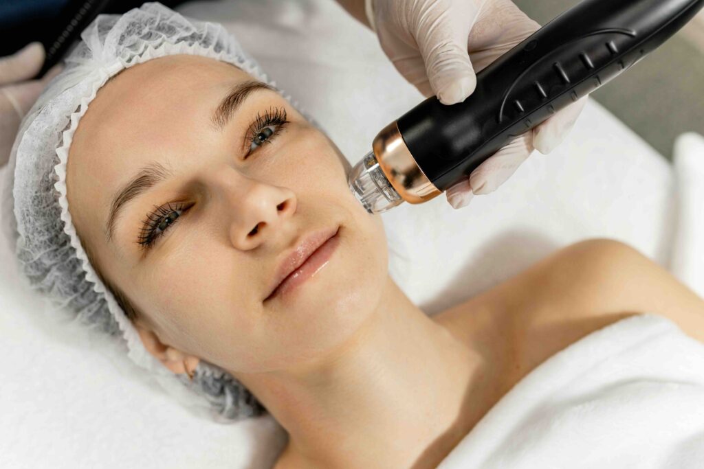 Microneedle RF lifting procedure. Hardware cosmetology. High quality photo